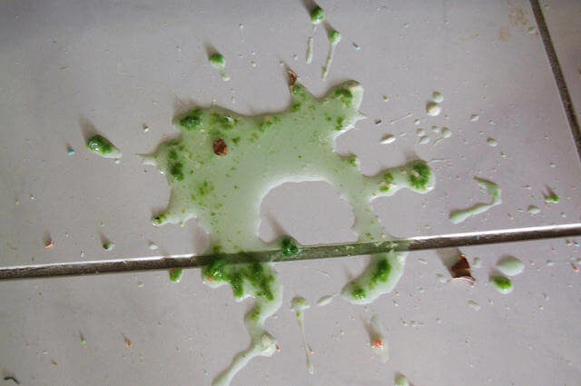 Psittakoz Hastası Kuş Dışkısı